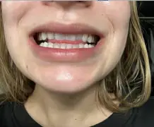 Purely White Deluxe Reviews 1