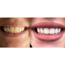 Purely White Deluxe Reviews 2